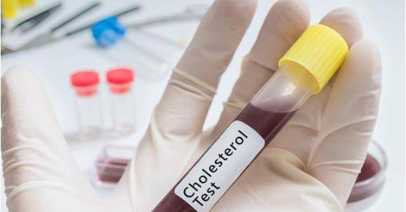 控制|瑞舒伐他汀降血脂，可以服用多长时间，有何副作用？医生为你详解