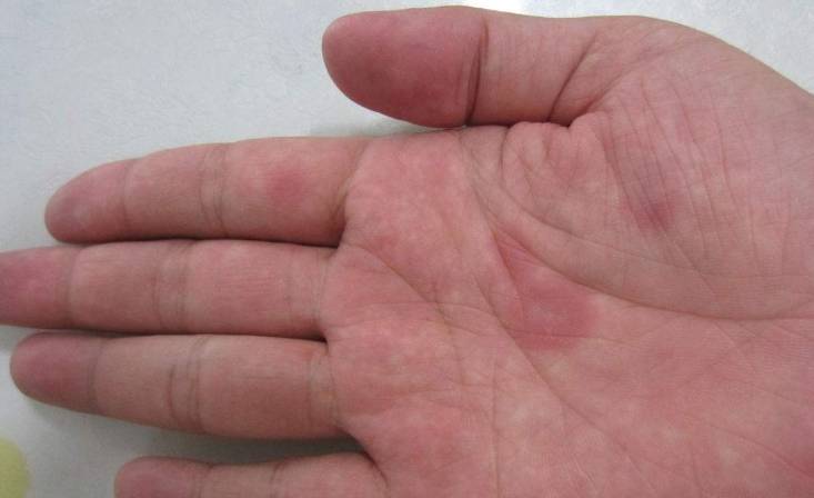 中指|肝好不好看手，手上若没有这3个“信号”，偷乐吧，肝比较健康