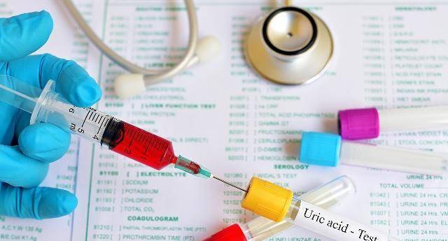 尿酸|尿酸超标的人，若身体出现3种“变化”，或许是肾衰竭找上门