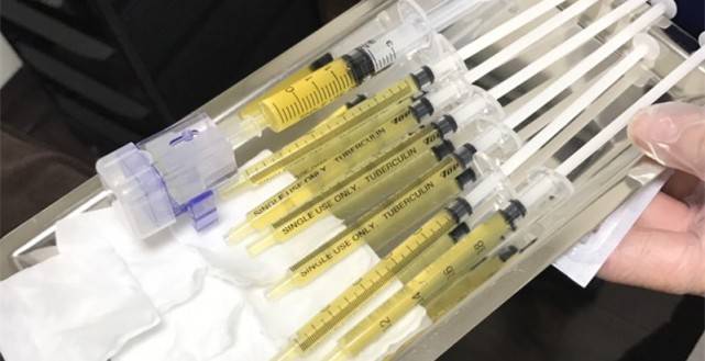 ENlivEN求助：干细胞可用于面部抗衰吗、干细胞美容针可以打吗？