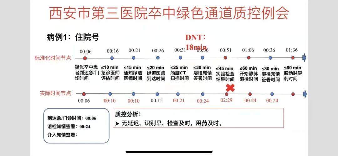 min|静脉溶栓 ▏DNT 18min