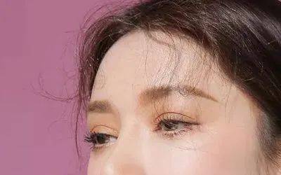 禁忌面部轮廓不流畅，填充还要分情况，太阳穴填充有什么禁忌？
