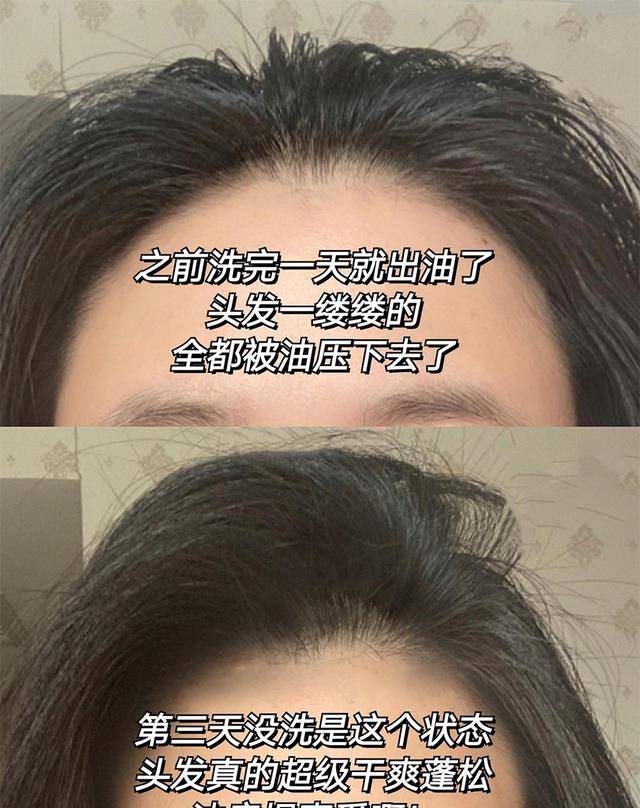 头皮身上有“体香”的女人，大多都有这“4个”习惯，难怪会招人喜欢