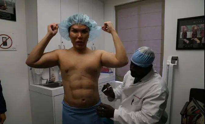 贾斯汀10年花了「一千万整容」，他成为了「芭比真人男友」！