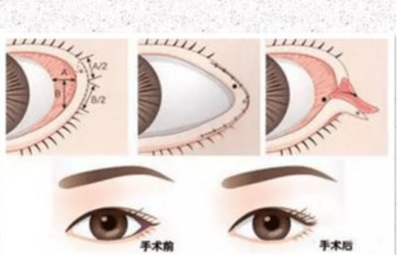 眼睛想要眼睛更大更灵动，可以做哪些改变？