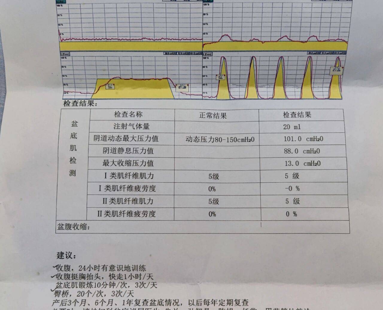 盆底肌修復是智商稅看完這篇你就懂了