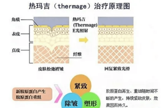 玛吉抚平面部衰老态，它的功效竟如此令人着迷！