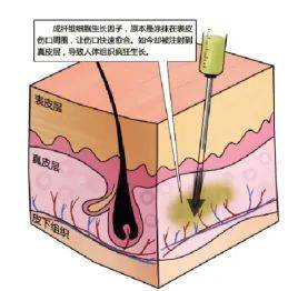 进行外泌体水光是“安全版”的生长因子吗？抗衰功效能不能放心？