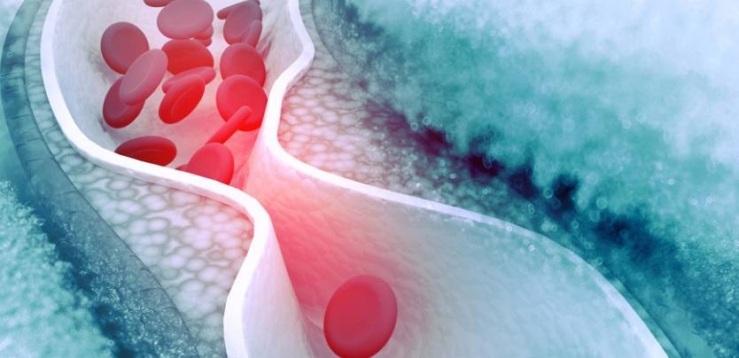 补充|女人晨起后空腹吃“此物”,清血管、降2高、养肠胃,不知道亏了
