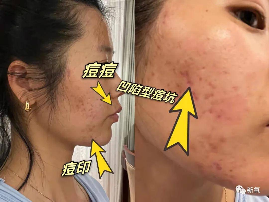预算预算不过万，我是怎么送粉丝出道的？
