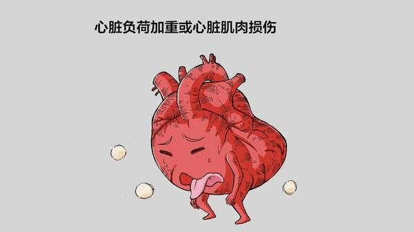 什么原因导致心率过缓呢 11888bd3d9744f1e8e2ba1d1e18194ad.png