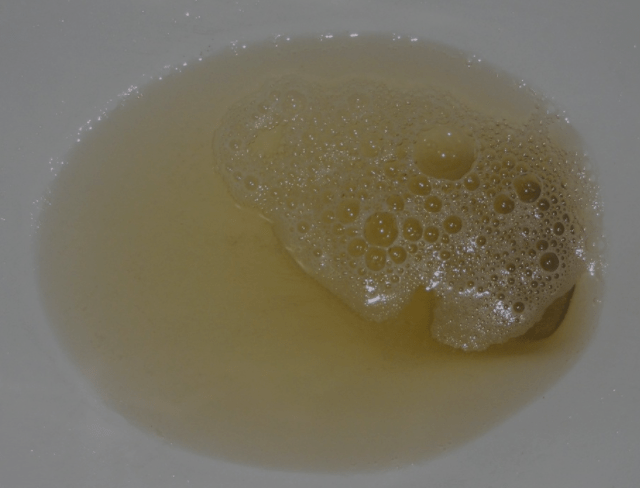 看完这几点,或许就明白了_肾脏_尿液_水分