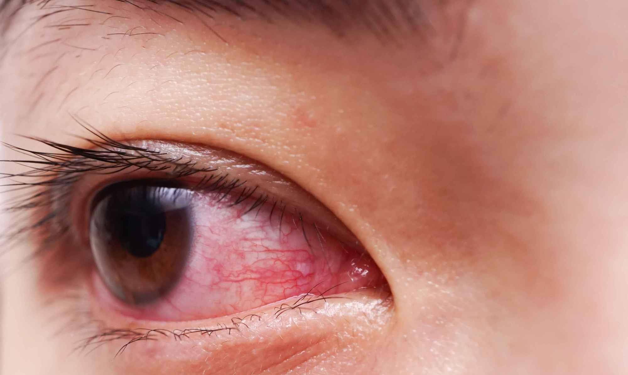 每年因熬夜猝死55万人 告诫 这5个信号,有一个都要赶紧休息