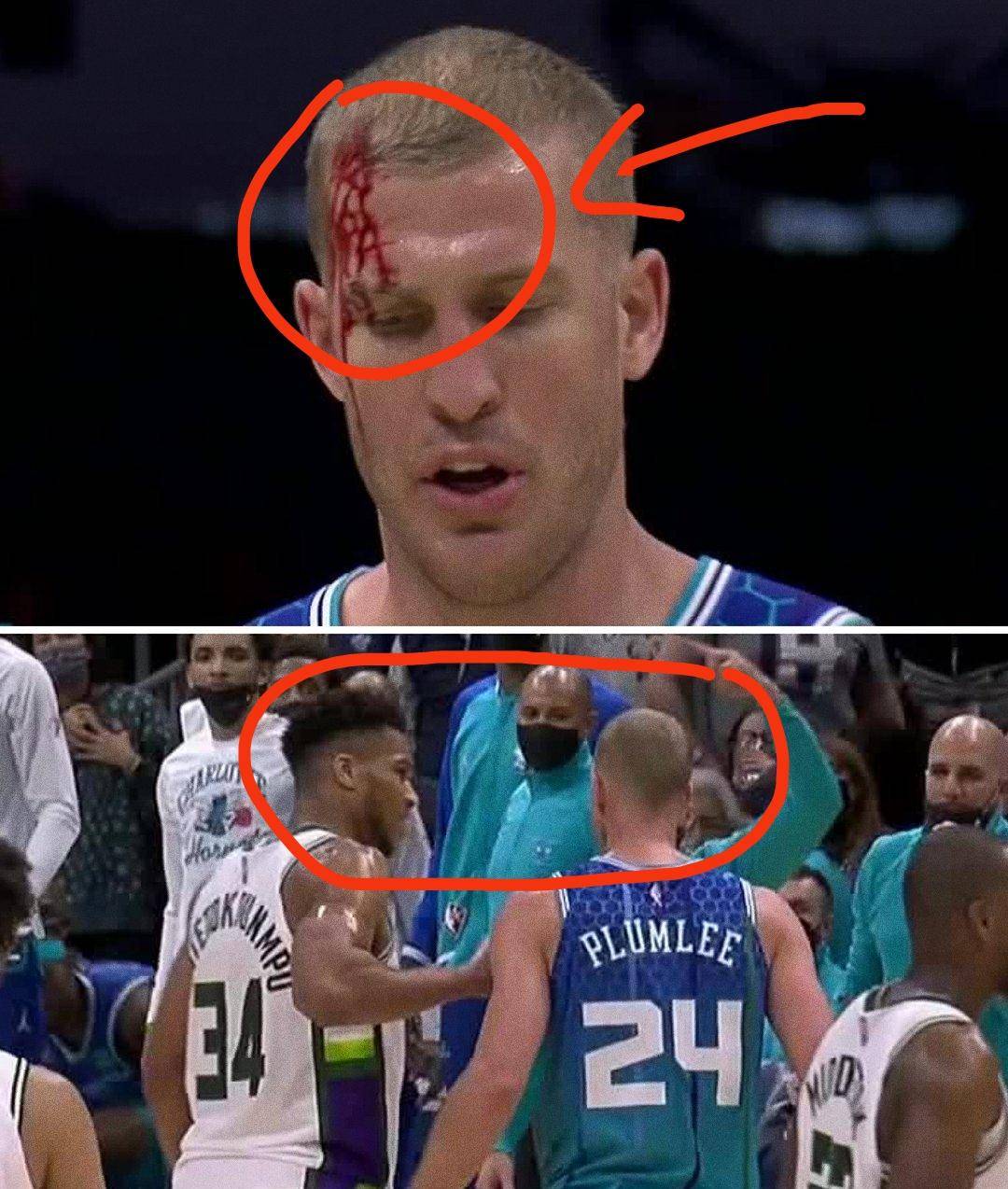 又伤人普拉姆利被打得额头出血谁注意到字母哥举动很暖心