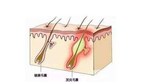 发型被宋祖儿逗笑！遇见粉丝求合影，赶紧去洗刘海，太可爱了