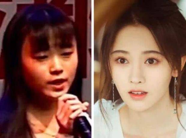 演技鞠婧祎陷整容争议？面部极不自然，发际线粉明显，网友直呼认不出