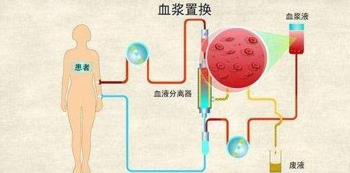 肾脏|此法可能降低尿蛋白和血肌酐，让肾脏重获新生