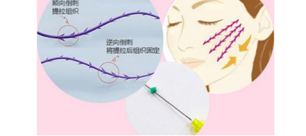 什么黄金微雕和线雕有什么区别？法令纹做线雕效果怎么样？