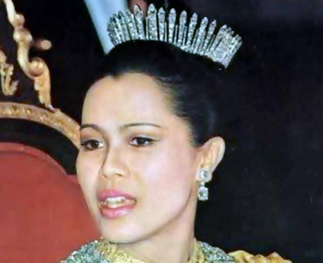 美貌西拉米视美貌为粪土，为迎合泰王审美，整成太后同款“香肠嘴”