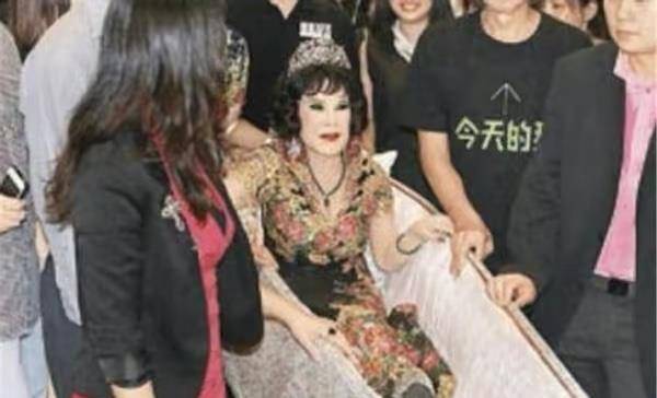 因为10位整容毁掉的女星：有人自己注射食用油，有人上瘾，有人丢了命