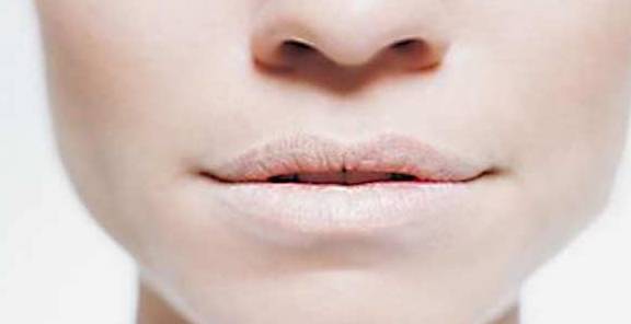 唇什么什么白成语_成语故事简笔画(4)