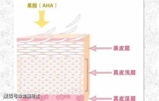 果酸真香警告，不看后悔！祛痘经验大分享，记录我从烂脸变健康皮的小妙招！