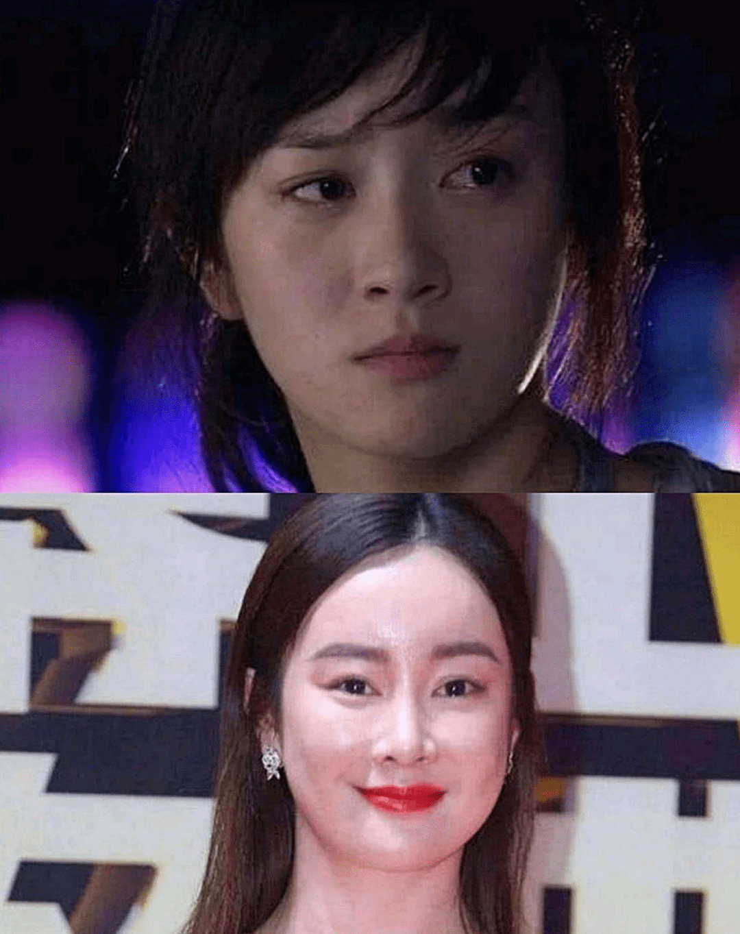 原创莫名其妙就歪嘴的女星金晨景甜都很严重这是动脸后遗症