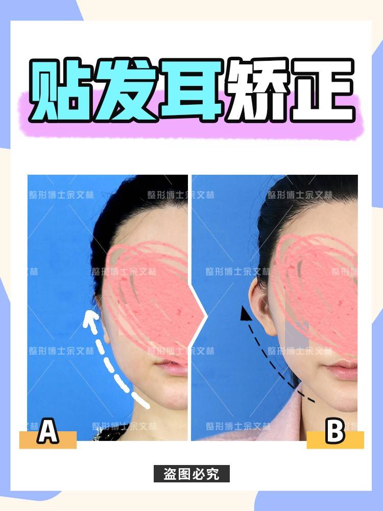 视觉【科普】贴发耳竟是脸大的“元凶”？