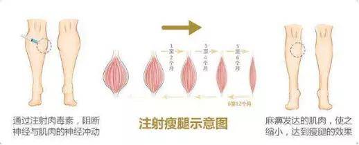 腰围酸了！男生的腿为什么比女生的还细？腿粗的妹子该怎么瘦腿？