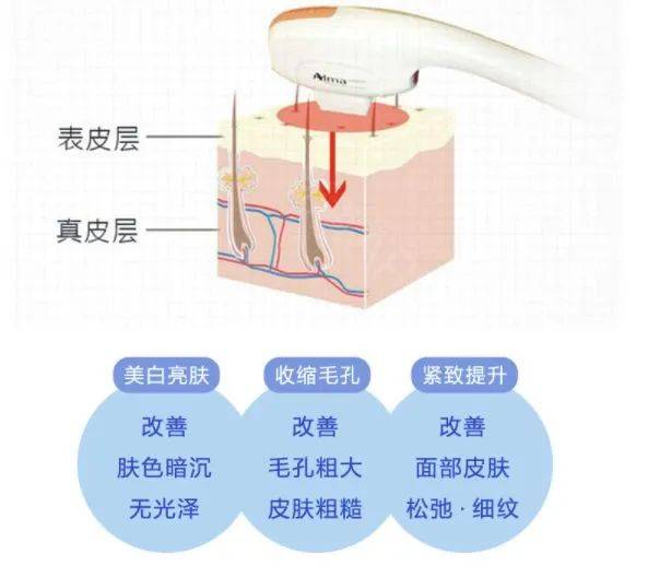 急救春节假期一周倒计时！时间紧迫，做点什么项目可以快速变美？