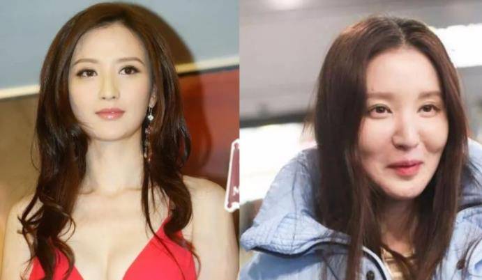 牛莉明星整容后遗症多严重？蔡明脸肿似馒头，刘晓庆面部僵硬没法细看