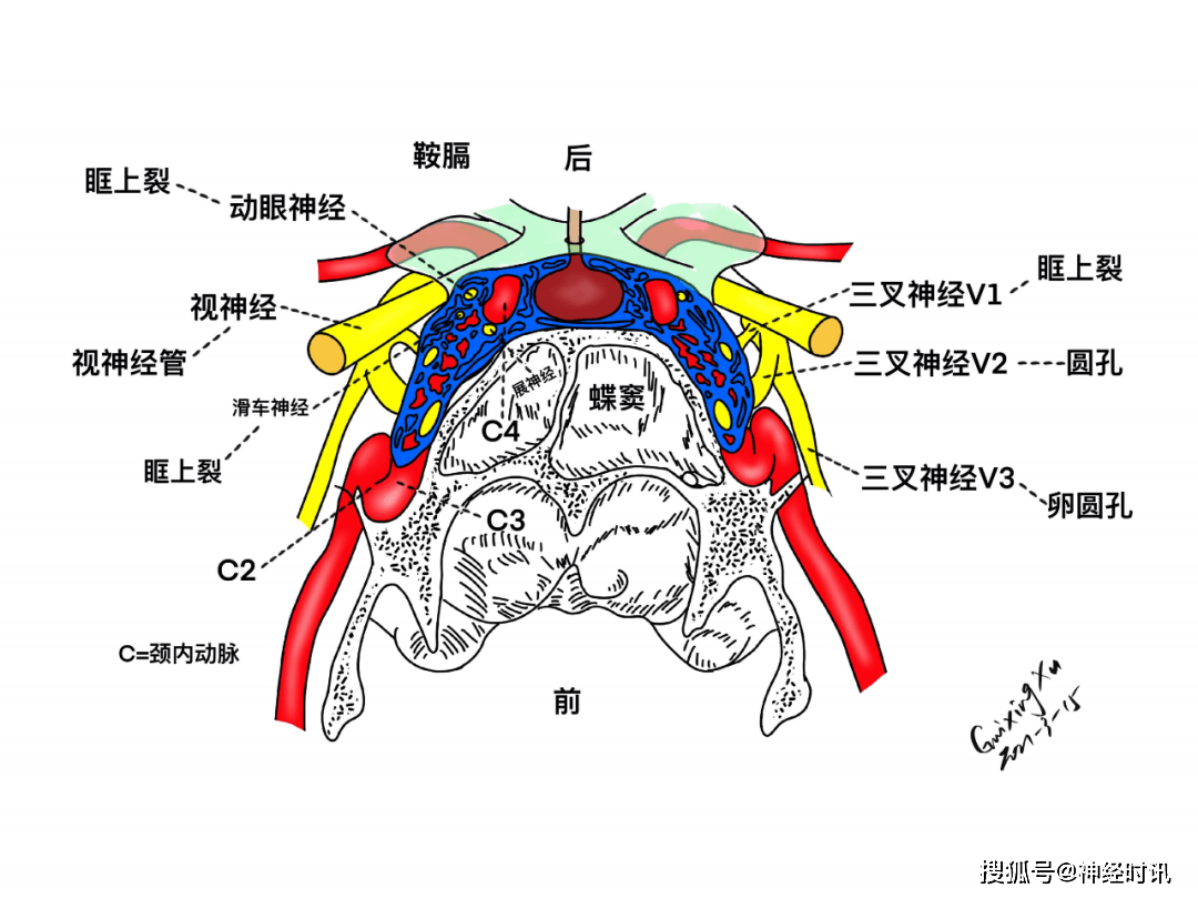 大脑交叉池图片