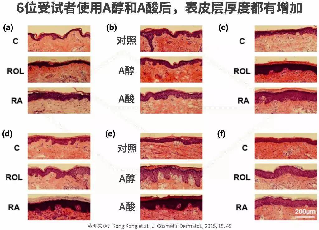 科技苗苗扒成分｜真正的抗老黑科技，再不试试有你后悔的！