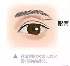 眉骨患11天痊愈后的Lisa，怎么完全认不出了…