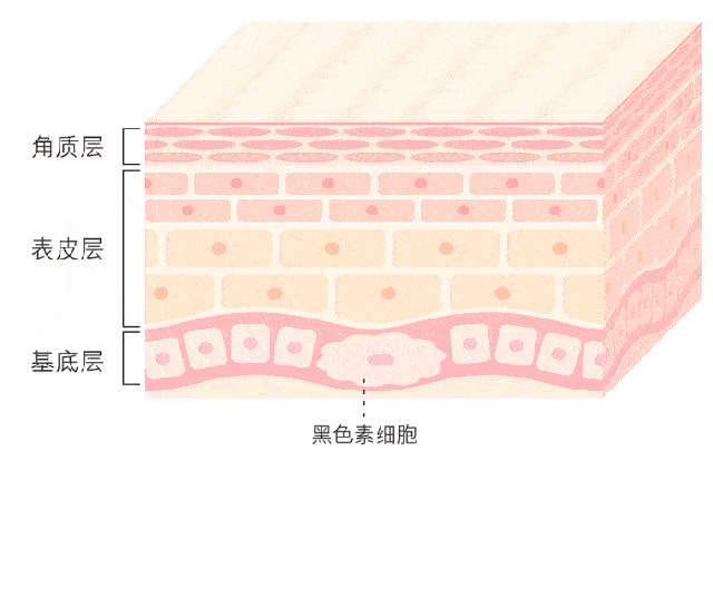 蝴蝶斑誓颜永恒：面部长斑，该怎么定制皮肤管理？