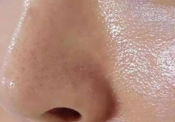 氧化为何早上刚涂的粉底，2个小时就“暗沉”？这4点很多人不知道