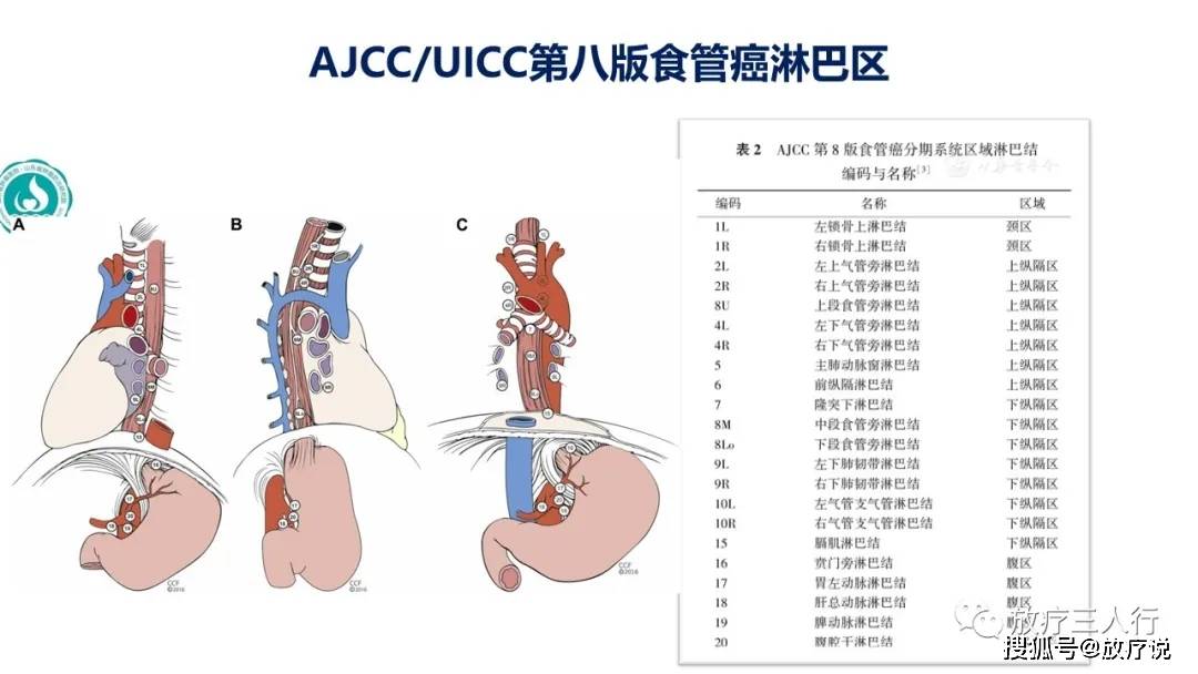 原创同与异黄伟黄勇教授uiccajccjes协会的肺癌食管癌淋巴结分区