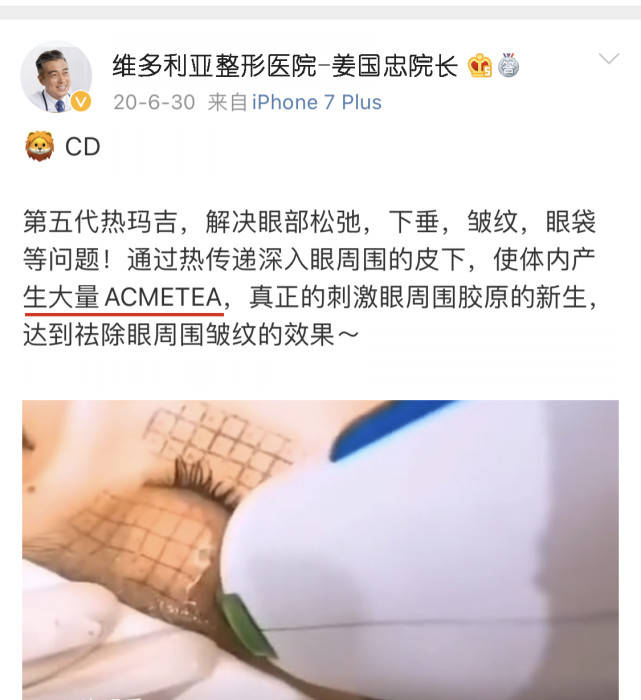 玛吉真相了：热玛吉是什么美容项目、热玛吉效果怎么样？