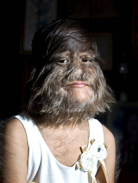 原创脸上长毛怎么去掉