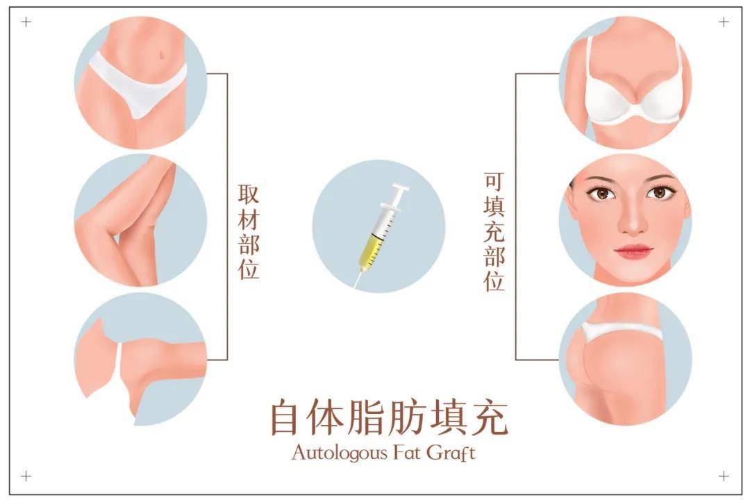 治疗医美知识 | 如何改善皱纹？