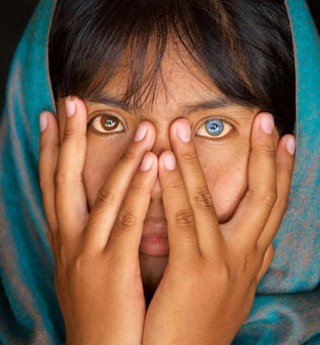 9,人的一双瞳孔并非都是同色的,这双异色瞳是不是让你一眼就被震撼,像