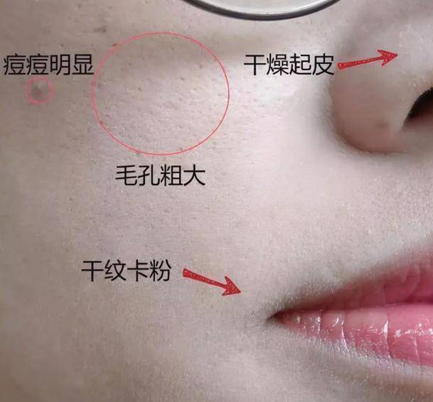 皮肤为何“不建议”女人常用粉底液？有“2个”原因，现在知道还不晚