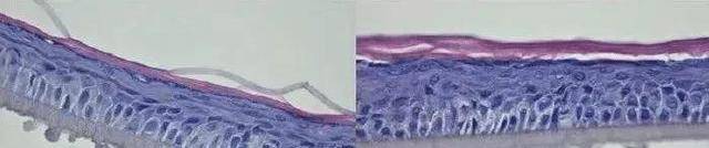 品牌继注射“玻酸”后，又一“抗衰老”方式走红，即安全还方便