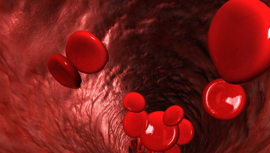 血管|血液黏稠度高的原因和危害，该如何改善？