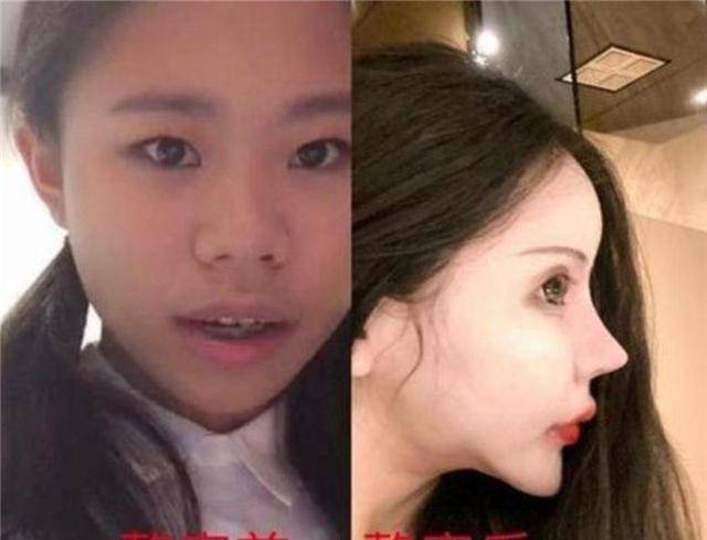 小孩子吉娜怀孕7月不显怀，小孩子练天鹅颈！别推广身材焦虑，做个人吧