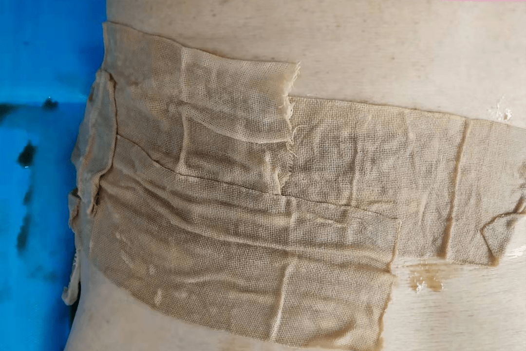 比我的亲人还要亲八旬老人为安徽静安医院中医科服务点赞