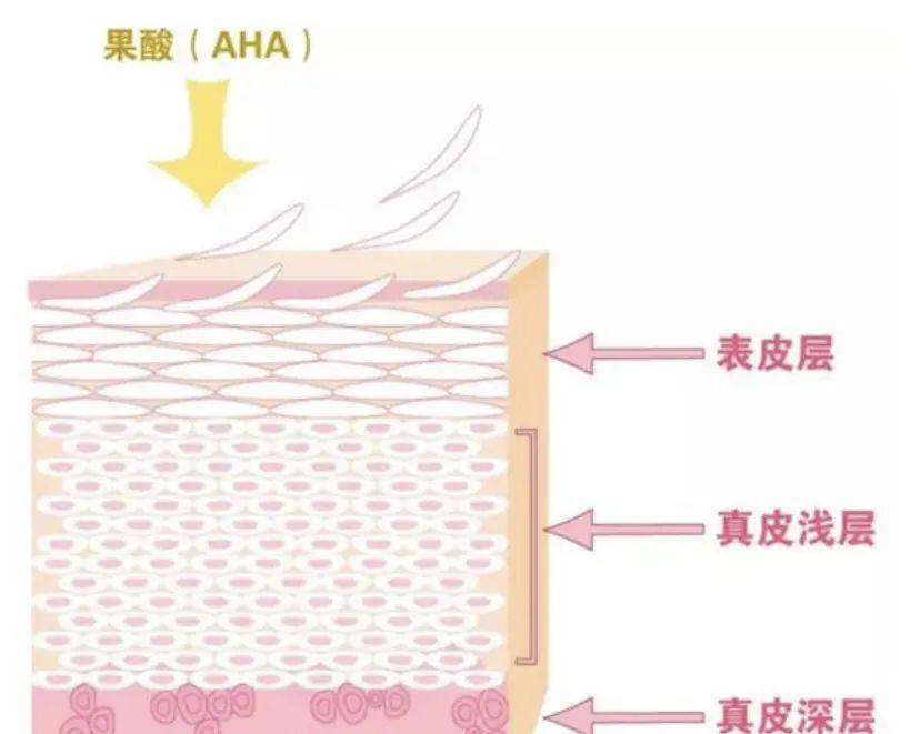 毛周她鼻背两旁的小疙瘩，到底是啥？