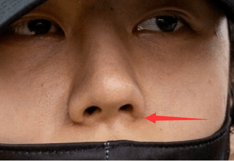 高清生浮粉、长痘、整容痕迹，明星未修图里的脸，让我看见了人间真实