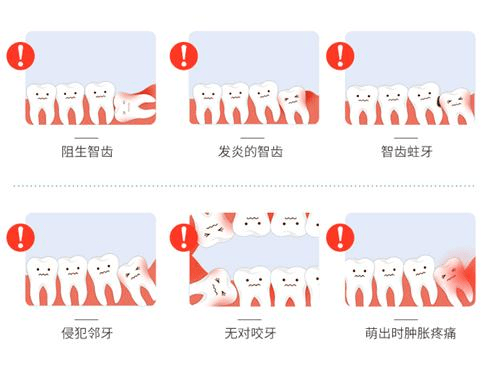 北京圣贝口腔关于智齿的问题这里一一解答