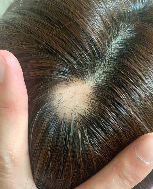 因为看脸是美女,头发一撩全完蛋!这些女星被发际线拖累,个个铁刘海